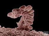 dataset/images/ecoli-0_vs_1.jpg