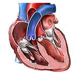 dataset/images/heart.jpg