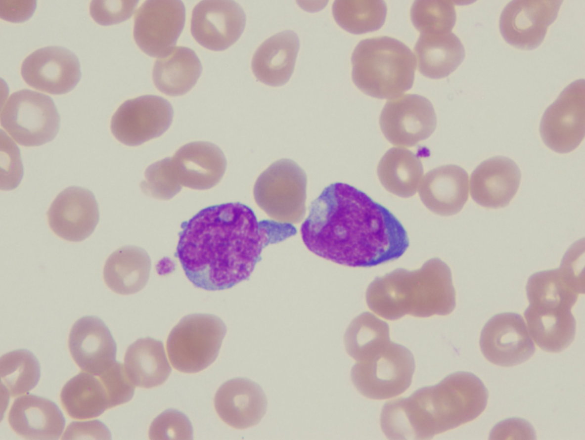 dataset/images/lymphography.jpg